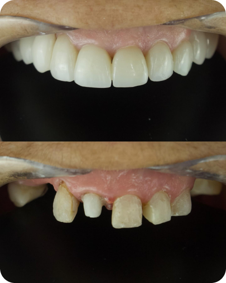 foto4
